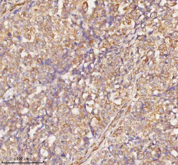 RNF25 Antibody