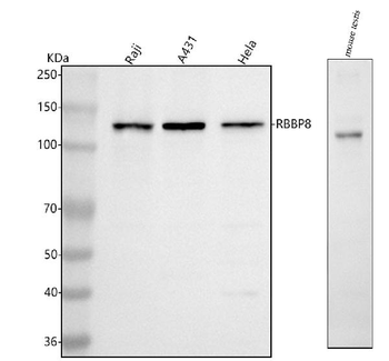 RBBP8 Antibody
