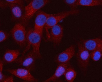 RASSF8 Rabbit Polyclonal Antibody