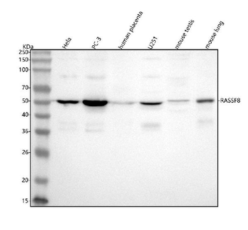 RASSF8 Rabbit Polyclonal Antibody