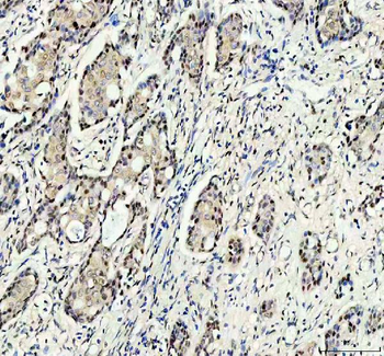 RANBP3 Rabbit Polyclonal Antibody