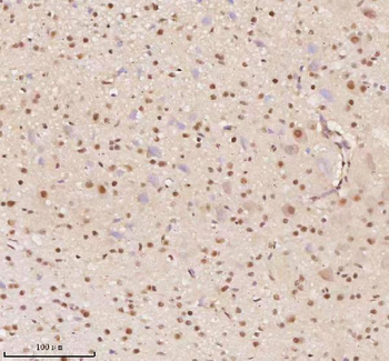 AATF Rabbit Polyclonal Antibody
