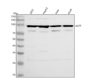AATF Rabbit Polyclonal Antibody