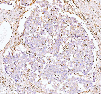 GNAI2 Rabbit Polyclonal Antibody