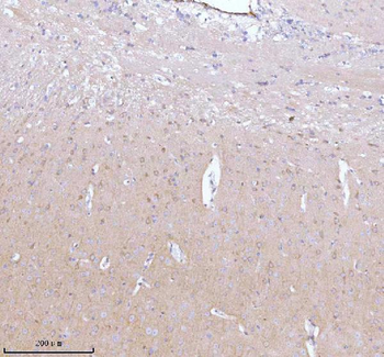 GNAI2 Rabbit Polyclonal Antibody
