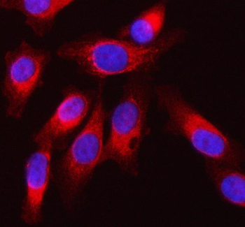 SQRDL/SQOR Rabbit Polyclonal Antibody