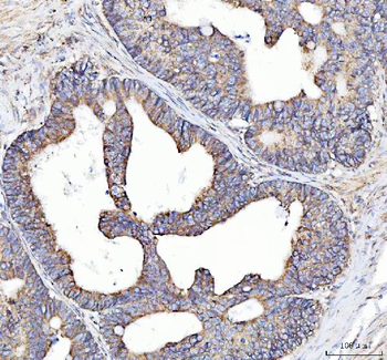 SQRDL/SQOR Rabbit Polyclonal Antibody