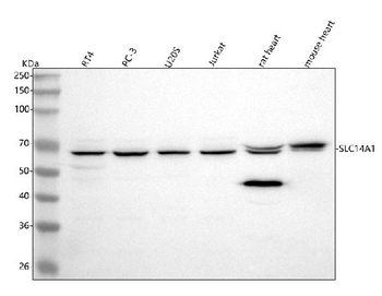 UT-B/SLC14A1 Antibody