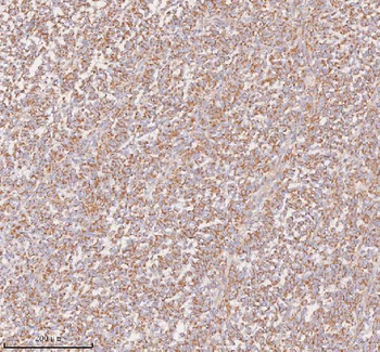 UT-B/SLC14A1 Antibody