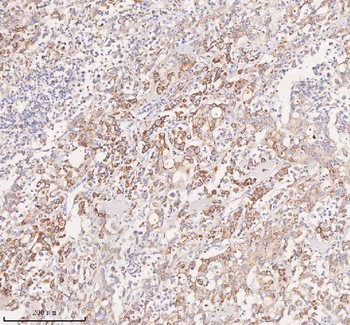 UT-B/SLC14A1 Antibody