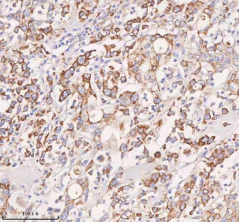 UT-B/SLC14A1 Antibody
