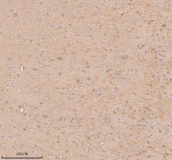 UT-B/SLC14A1 Antibody