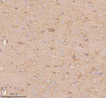 UT-B/SLC14A1 Antibody