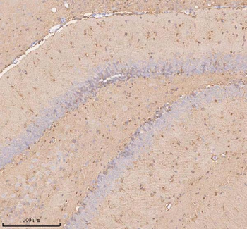 UT-B/SLC14A1 Antibody