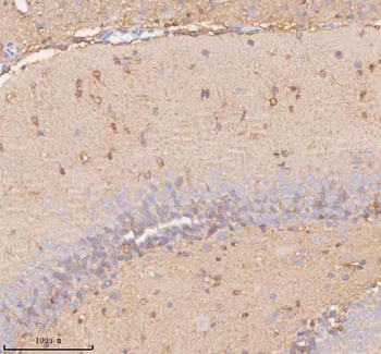 UT-B/SLC14A1 Antibody