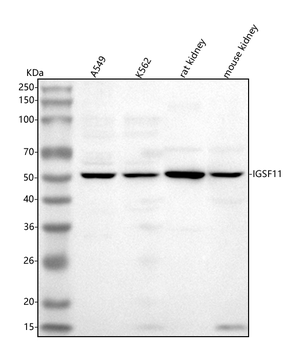 IGSF11 Rabbit Polyclonal Antibody