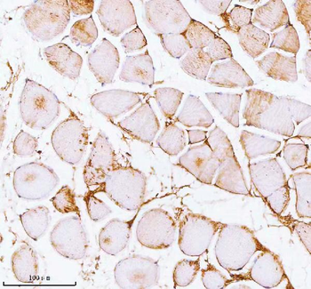 PFKM Antibody