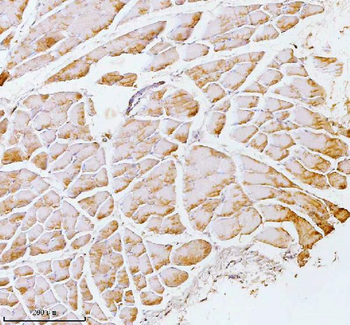 PFKM Antibody