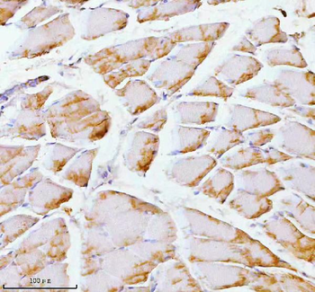 PFKM Antibody