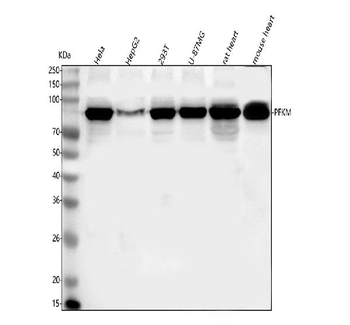 PFKM Antibody