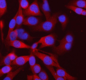 PFKM Antibody