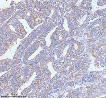 PFKM Antibody