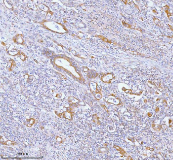 PFKM Antibody