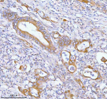 PFKM Antibody