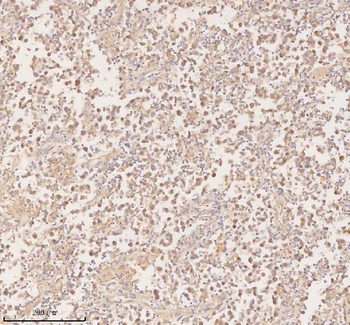 PFKM Antibody