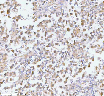 PFKM Antibody