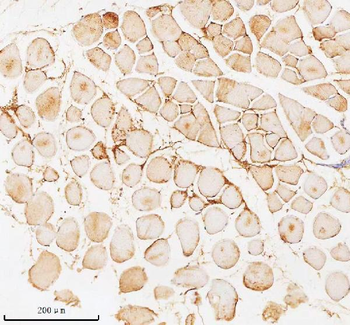 PFKM Antibody