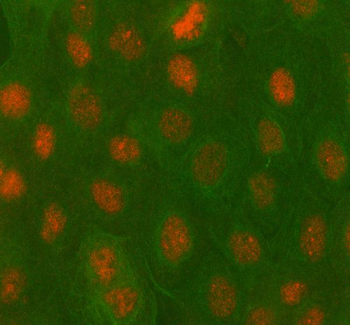PBX4 Rabbit Polyclonal Antibody