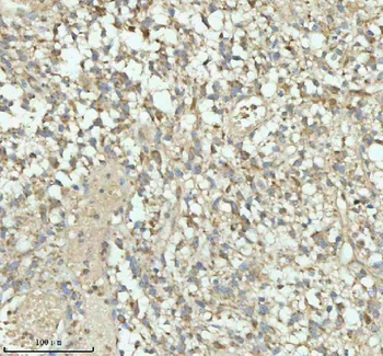 PACSIN1 Antibody