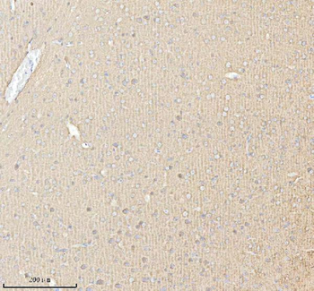 PACSIN1 Antibody