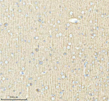 PACSIN1 Antibody