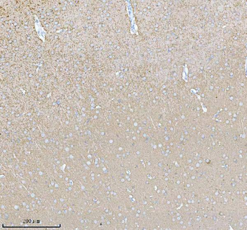 PACSIN1 Antibody