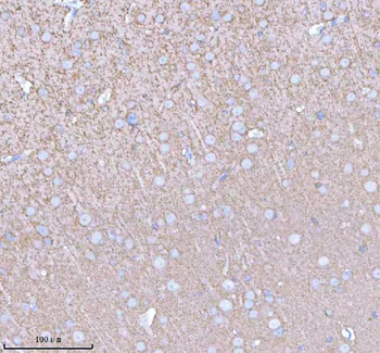 PACSIN1 Antibody