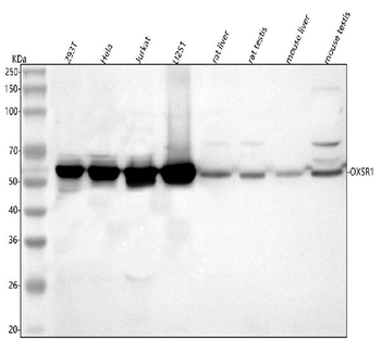 OXSR1 Rabbit Polyclonal Antibody