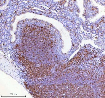 Lat Antibody