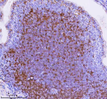 Lat Antibody