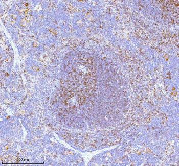 Lat Antibody