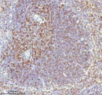 Lat Antibody