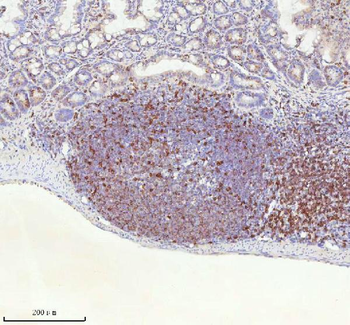 Lat Antibody