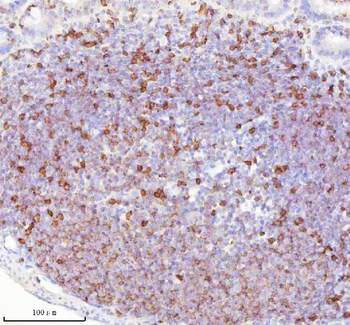 Lat Antibody