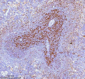 Lat Antibody