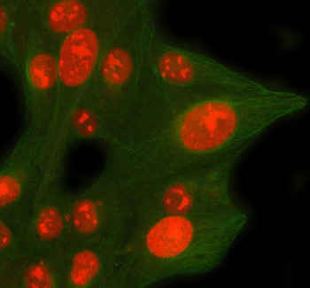 CDCA8 Rabbit Polyclonal Antibody