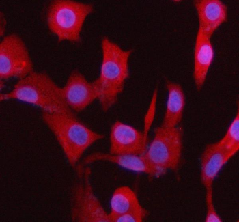 BCCIP Rabbit Polyclonal Antibody