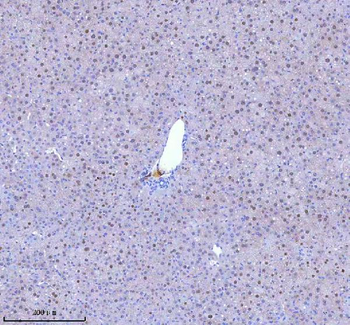 BCCIP Rabbit Polyclonal Antibody