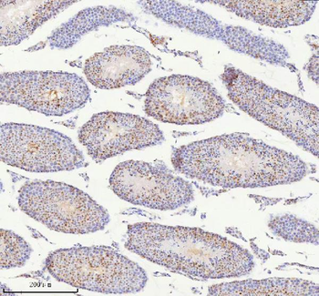 BCCIP Rabbit Polyclonal Antibody