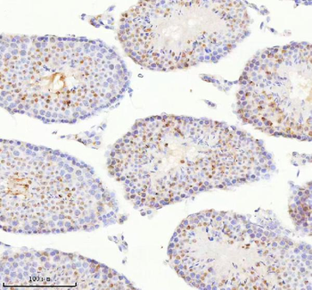 BCCIP Rabbit Polyclonal Antibody